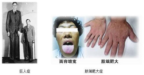 正常人的甲状腺图片,结构、功能与影像学特征